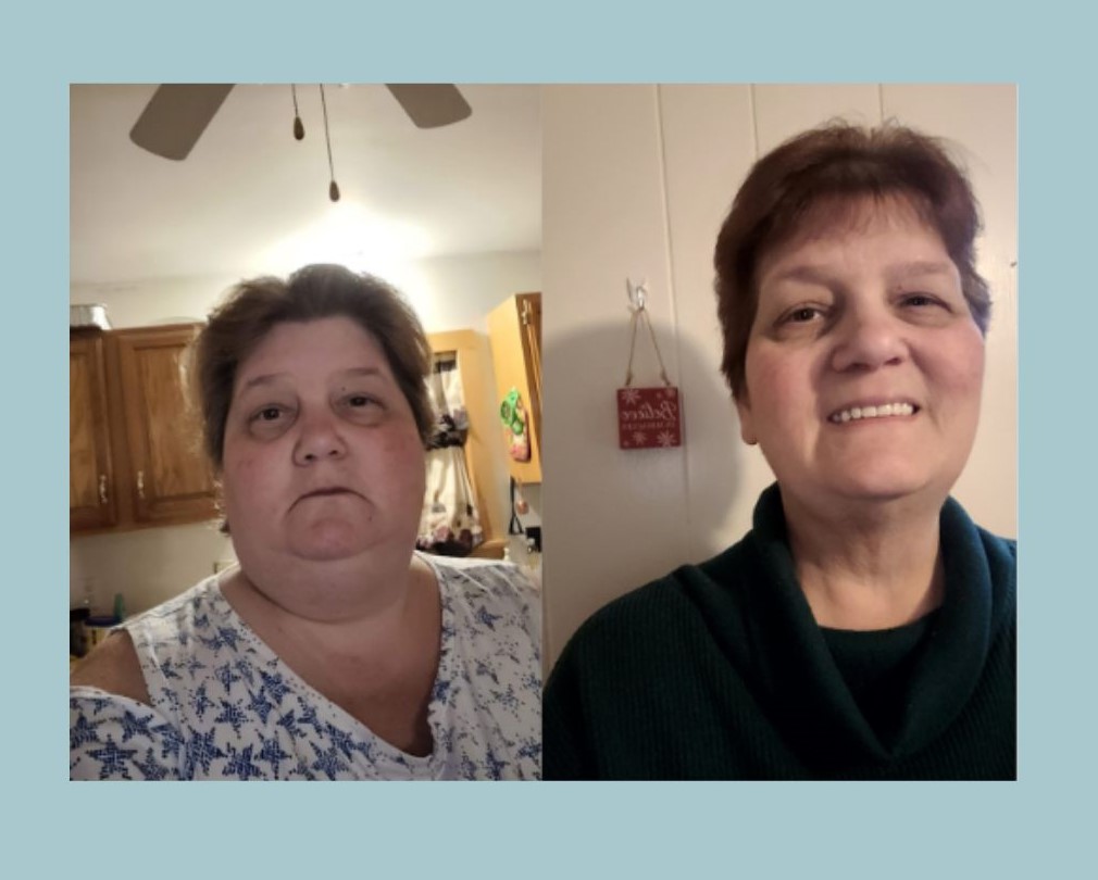 Before and after photo of Tammy omparison weight Loss.